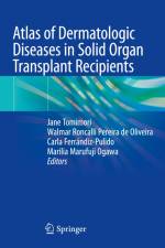 Atlas of Dermatologic Diseases in Solid Organ Transplant Recipients af Jane Tomimori