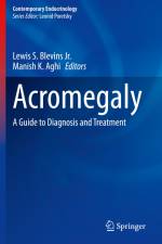 Acromegaly af Manish K. Aghi