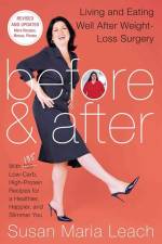 Before & After, Second Revised Edition af Susan Maria Leach