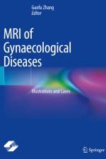 MRI of Gynaecological Diseases af Guofu Zhang