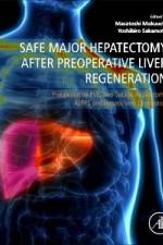 Safe Major Hepatectomy After Preoperative Liver Regeneration af Yoshihiro Sakamoto