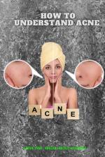 How to understand Acne af Ubaldo Sánchez Gutiérrez