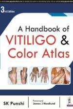 A Handbook of Vitiligo & Color Atlas af SK Punshi