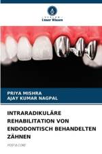 INTRARADIKULÄRE REHABILITATION VON ENDODONTISCH BEHANDELTEN ZÄHNEN af Priya Mishra