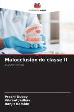 Malocclusion de classe II af Prachi Dubey
