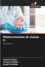 Malocclusione di classe II af Prachi Dubey