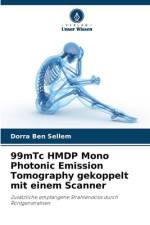 99mTc HMDP Mono Photonic Emission Tomography gekoppelt mit einem Scanner af Dorra Ben Sellem