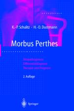 Morbus Perthes af Klaus-Peter Schulitz