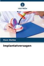 Implantatversagen af Hiam Wehbe