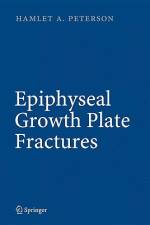 Epiphyseal Growth Plate Fractures af Hamlet A. Peterson