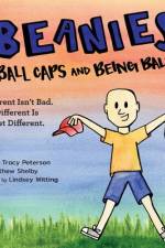Beanies, Ball Caps, and Being Bald af Tracy Peterson