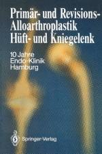 Primär- und Revisions-Alloarthroplastik Hüft- und Kniegelenk af Endo-Klinik