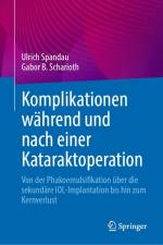 Komplikationen während und nach einer Kataraktoperation af Ulrich Spandau
