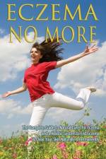Eczema No More af Jason S Bradford