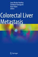 Colorectal Liver Metastasis af Jean-Nicolas Vauthey