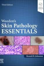 Weedon's Skin Pathology Essentials af Ronald Johnston