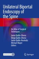 Unilateral Biportal Endoscopy of the Spine af Javier Quillo-Olvera