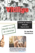 Controle Ud. mismo el Vitiligo af Jose Moya