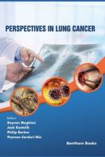 Perspectives in Lung Cancer af Jack Kastelik