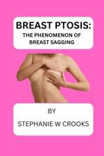 Breast Ptosis af Stephanie W Crooks