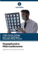 Hypophysäre Makroadenome af Iridia Ferrán Zúñiga