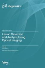 Lesion Detection and Analysis Using Optical Imaging