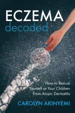 Eczema Decoded af Carolyn Akinyemi