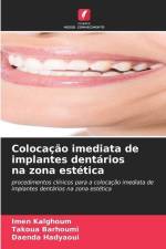 Colocação imediata de implantes dentários na zona estética af Imen Kalghoum