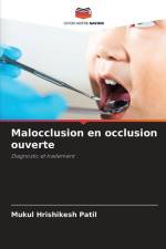 Malocclusion en occlusion ouverte af Mukul Hrishikesh Patil