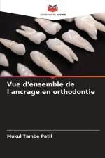 Vue d'ensemble de l'ancrage en orthodontie af Mukul Tambe Patil