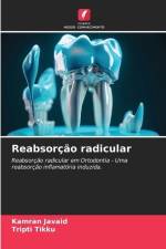 Reabsorção radicular af Kamran Javaid