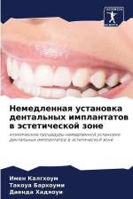 Nemedlennaq ustanowka dental'nyh implantatow w ästeticheskoj zone af Imen Kalghoum
