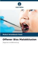 Offener Biss Malokklusion af Mukul Hrishikesh Patil