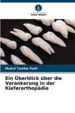 Ein Überblick über die Verankerung in der Kieferorthopädie af Mukul Tambe Patil
