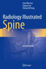 Radiology Illustrated: Spine af Joon Woo Lee