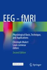EEG - fMRI af Louis Lemieux