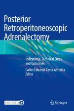 Posterior Retroperitoneoscopic Adrenalectomy af Carlos Eduardo Costa Almeida