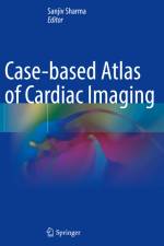 Case-based Atlas of Cardiac Imaging af Sanjiv Sharma