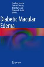 Diabetic Macular Edema af Sandeep Saxena