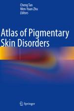 Atlas of Pigmentary Skin Disorders af Wen-Yuan Zhu