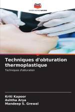 Techniques d'obturation thermoplastique af Kriti Kapoor