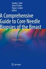 A Comprehensive Guide to Core Needle Biopsies of the Breast af Sandra J. Shin
