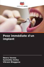 Pose immédiate d'un implant af Neeru Verma