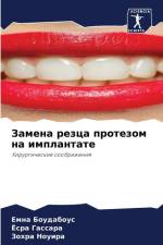 Zamena rezca protezom na implantate af Emna Boudabous