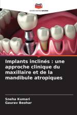 Implants inclinés : une approche clinique du maxillaire et de la mandibule atropiques af Sneha Kumari