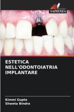 ESTETICA NELL'ODONTOIATRIA IMPLANTARE af Kimmi Gupta