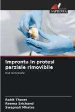 Impronta in protesi parziale rimovibile af Rohit Thorat