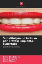 Substituição do incisivo por prótese implanto-suportada af Emna Boudabous
