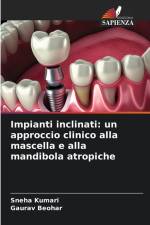 Impianti inclinati: un approccio clinico alla mascella e alla mandibola atropiche af Sneha Kumari