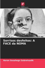 Sorrisos desfeitos: A FACE da NOMA af Heron Gezahegn Gebretsadik